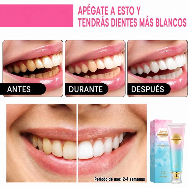 Oralhoe — Dientes más blancos sin pagar miles de pesos en el dentista. 🎁Lleva 2 y 3 Con Descuento