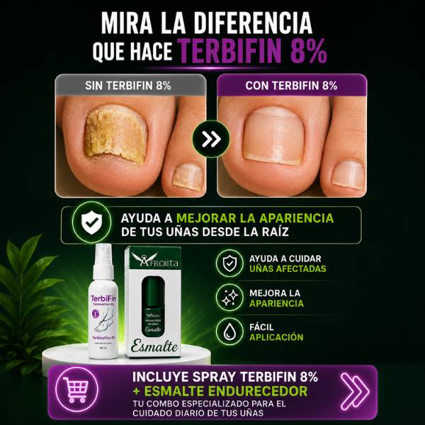 TERBIFIN 8% SPRAY  Uñas con mejor aspecto • Fácil aplicación 🎁 Pídelo hoy y llévate GRATIS Endurecedor de uñas